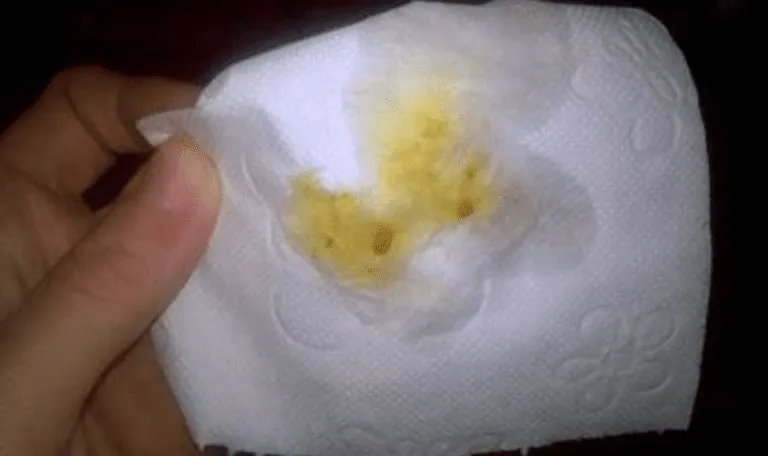 Mucus discharge after passing stool