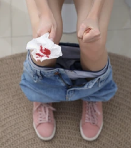 Difficulty cleaning after bowel movement