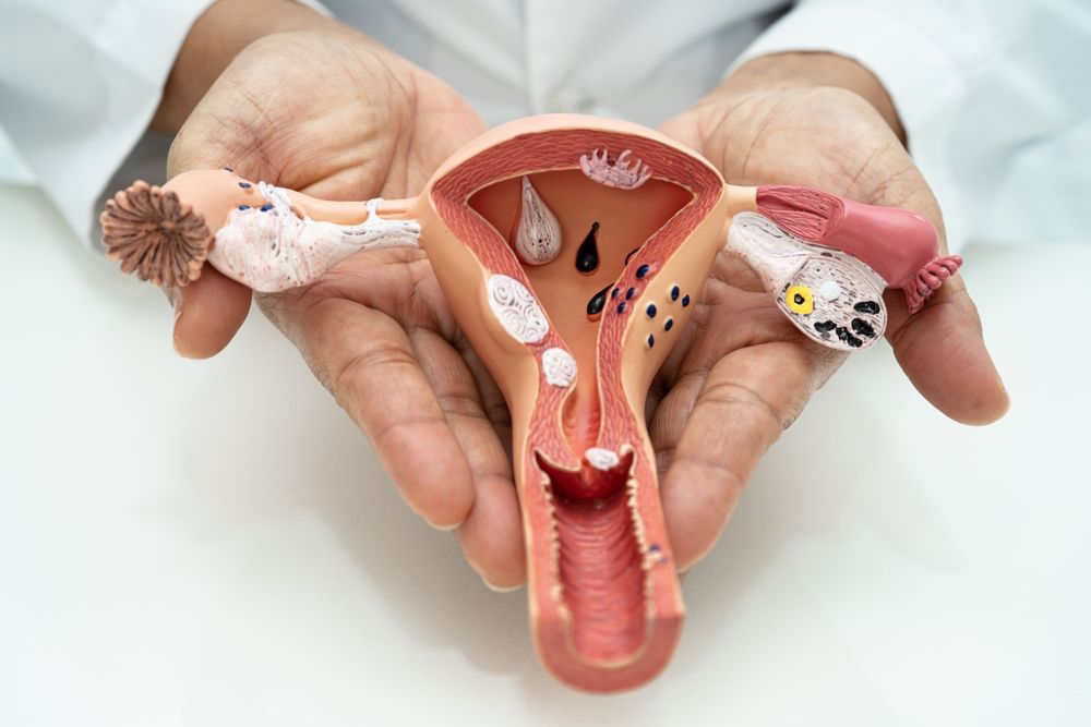 Ovarian Cystectomy