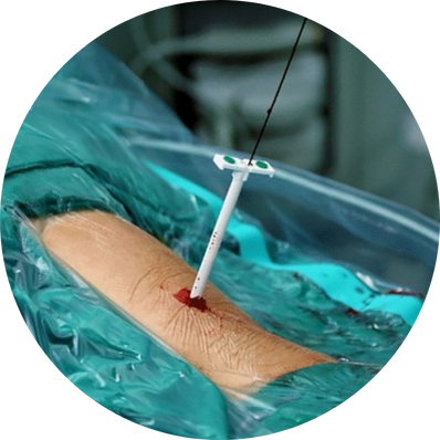 Standard PCNL