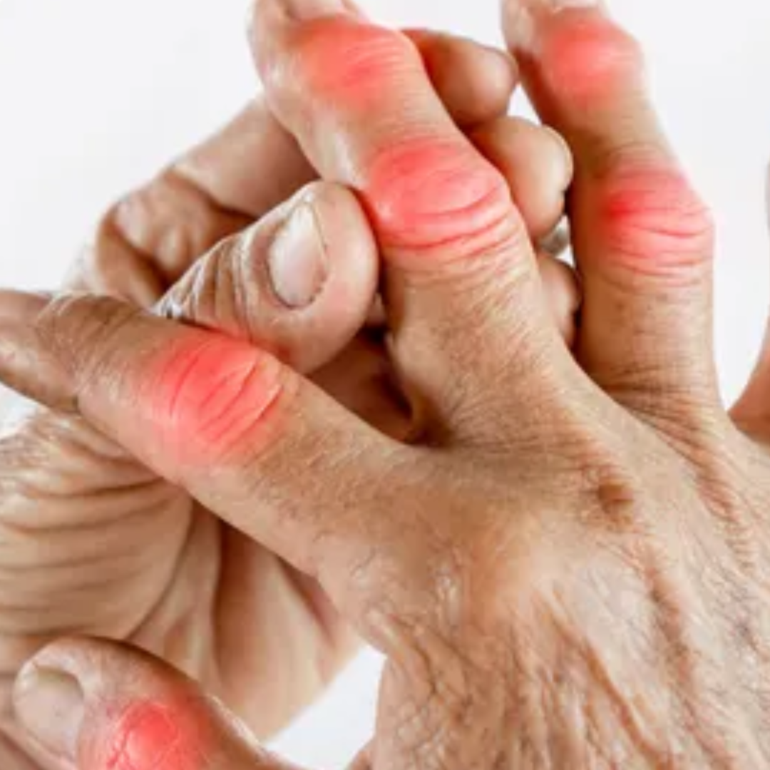 Pain or tenderness at the base of the affected finger