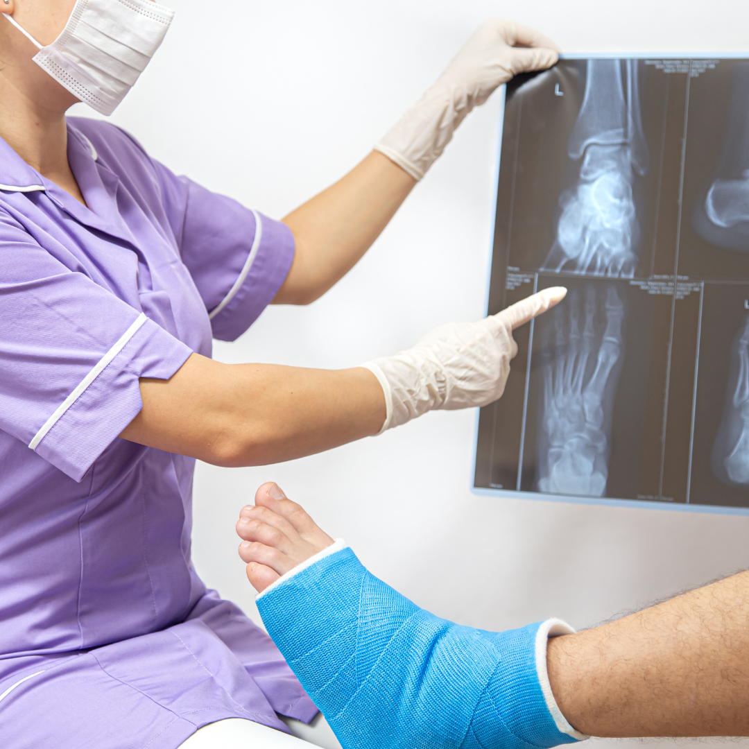 Open fractures