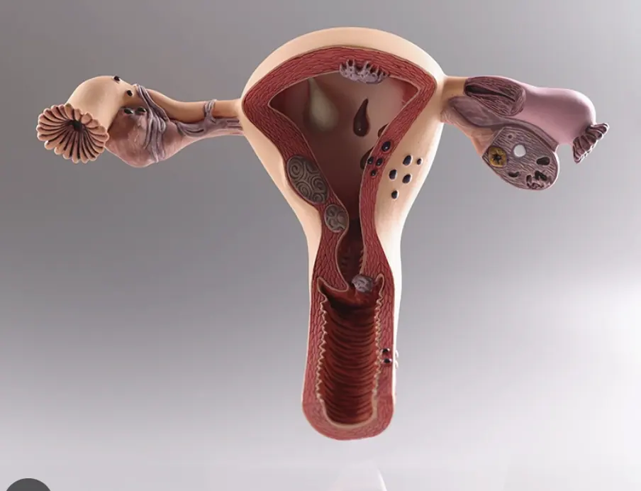Abnormal or heavy uterine bleeding