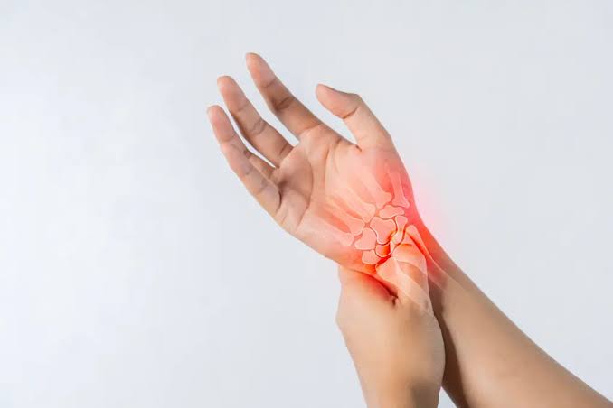Carpal Tunnel Release
