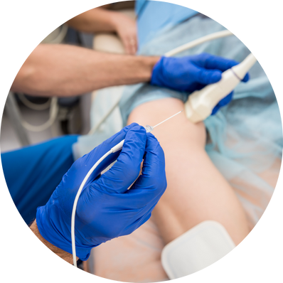 Thermal Balloon Ablation