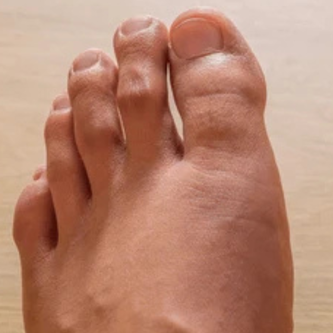 Visible deformity or gap under the skin