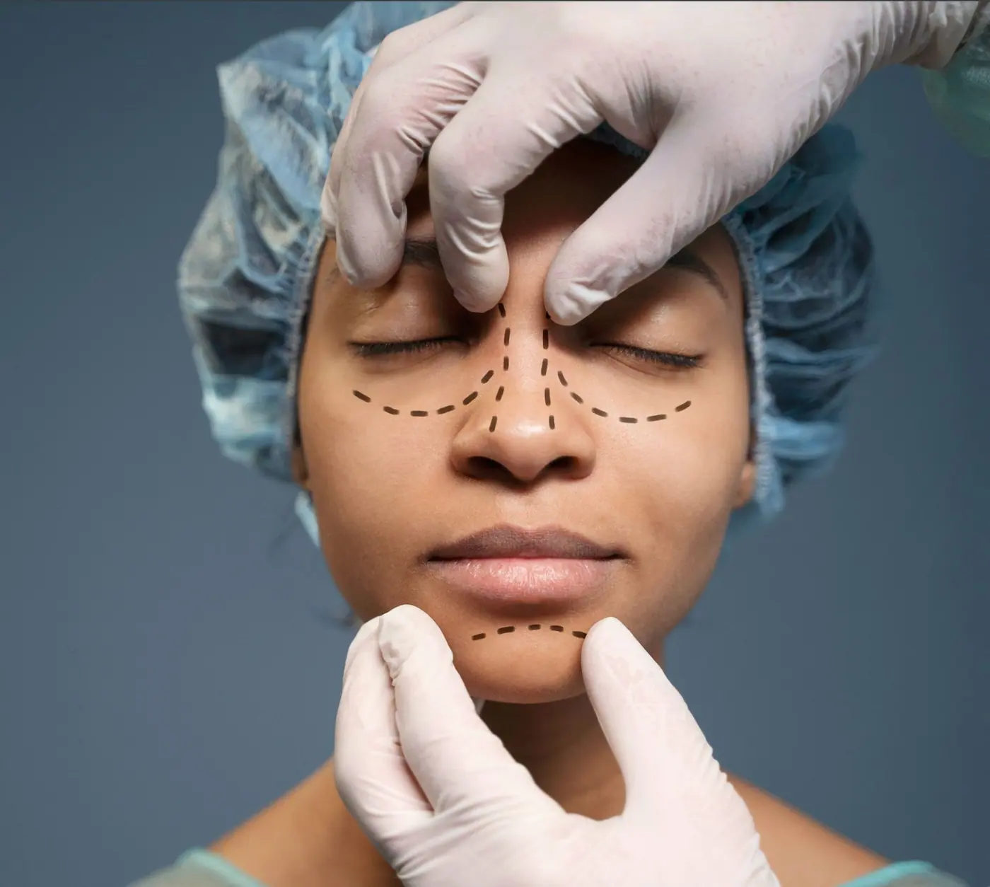 Septoplasty