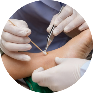 Surgical/Sharp Debridement