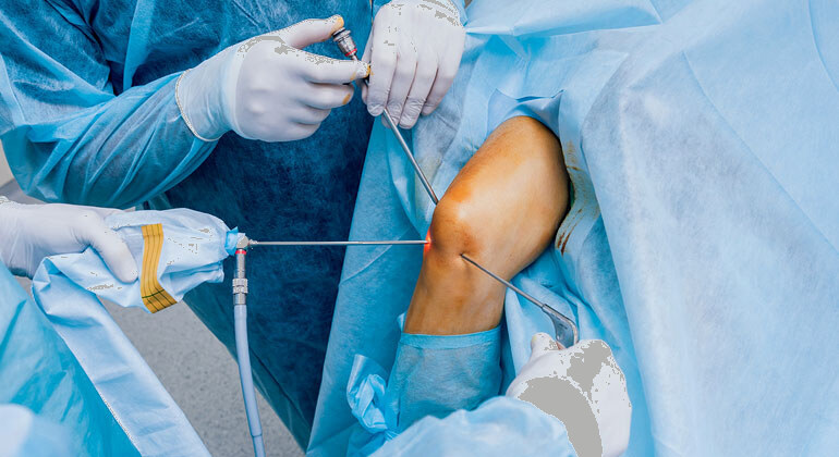 Knee / Shoulder Arthroscopy
